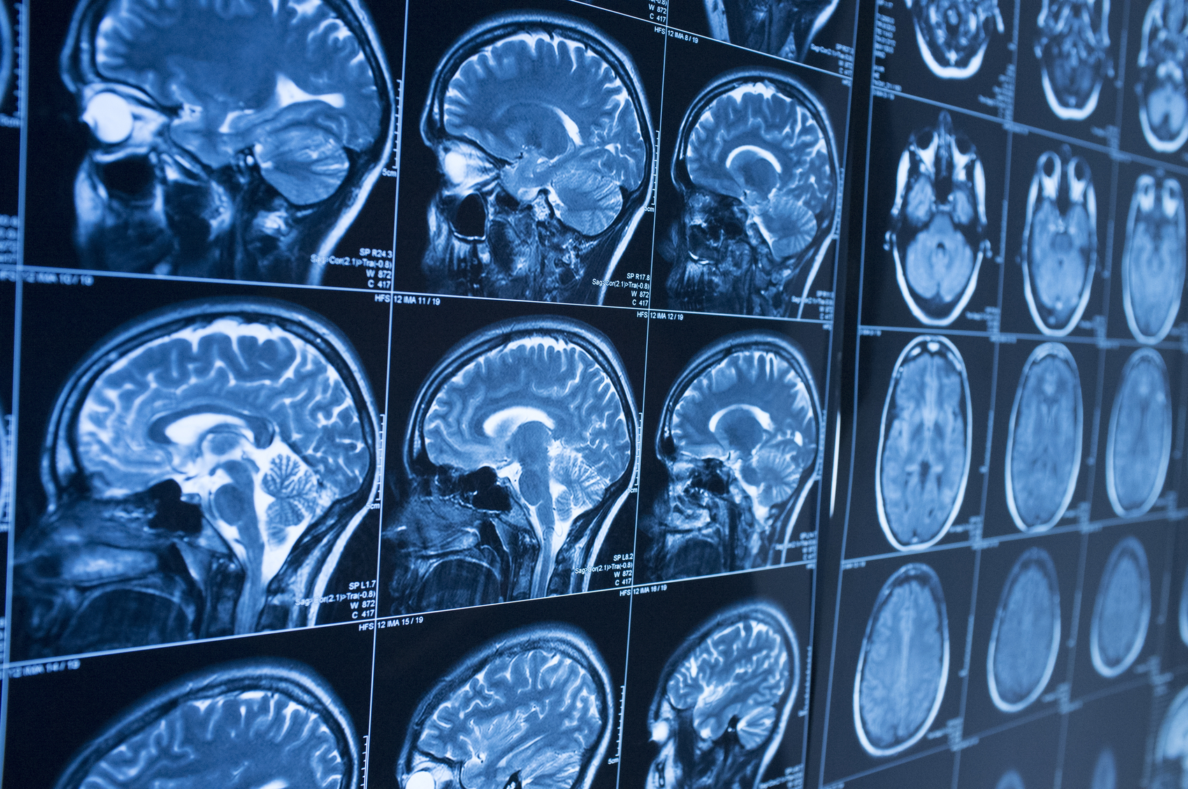 What Does CTE Mean?